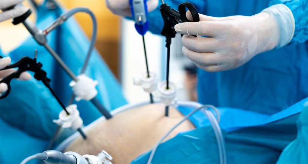 Bariatric Treatment