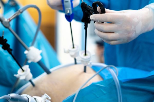 Bariatric Treatment